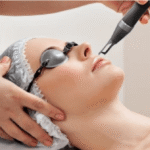 Exploring the Results, Advantages, and Expected Outcomes of Laser Treatments for Hyperpigmentation